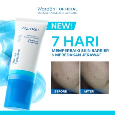 Wardah Derma Sensitive Moisturizer