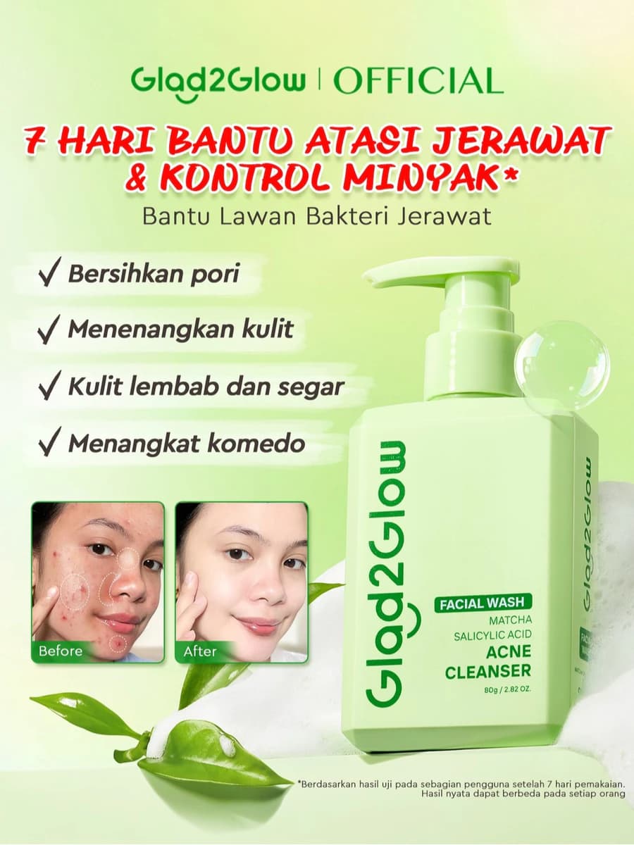 Glad2Glow Matcha Salicylic Acid Acne Cleanser