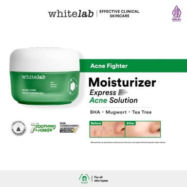 Whitelab Acne Care Moisturizer Gel 30g
