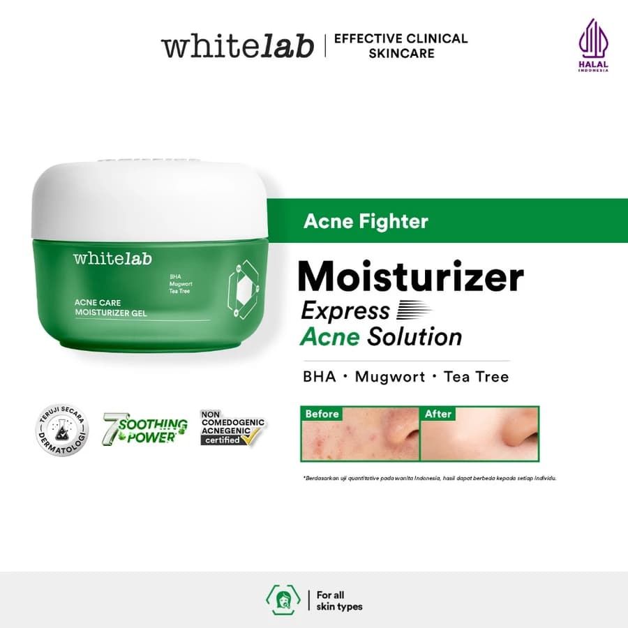 Whitelab Acne Care Moisturizer Gel 30g