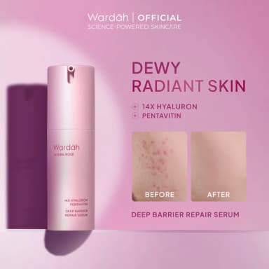 WARDAH Hydra Rose 14X Hyaluronic Pentavitin Deep Barrier Repair Serum