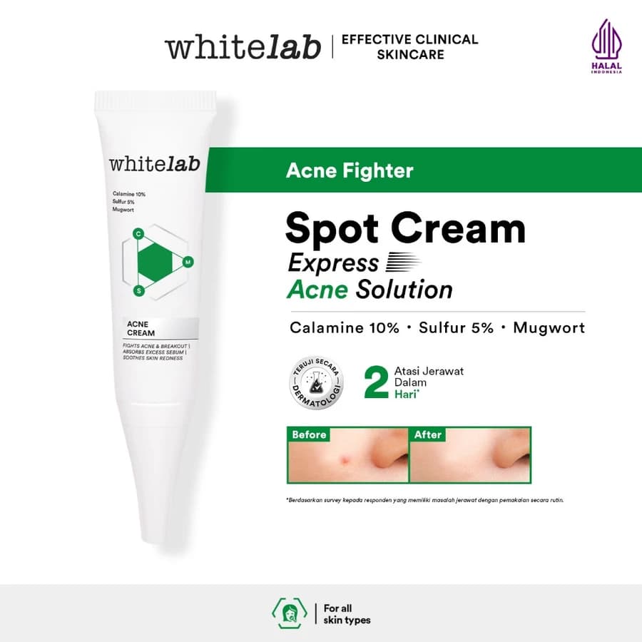 Whitelab Acne Cream - Krim Totol Jerawat dengan Sulfur, Calamine and Mugwort 15g