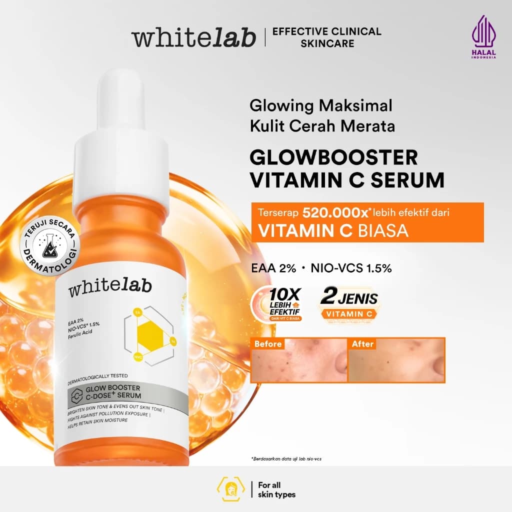 Whitelab Serum Vitamin C Glow Booster 15ml